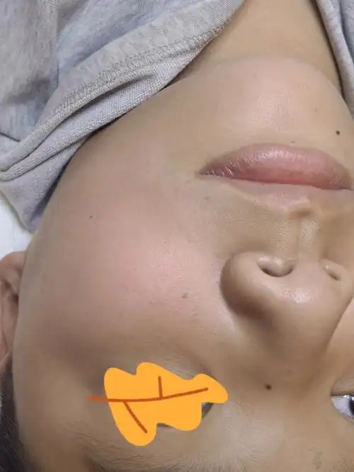 小朋友点完痣介绍同学也来点痣,妈妈说:长成北斗七星