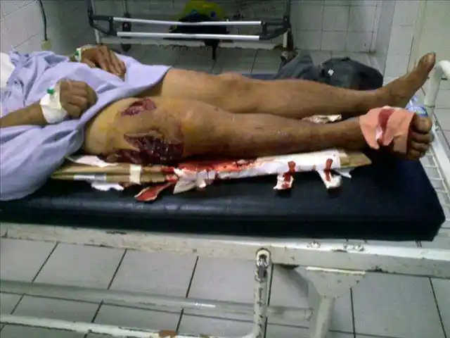 告诉你中枪后的感觉