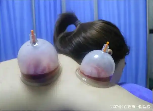 【特色外治】壮医帮你治疗肩周炎(旁巴尹),招招见效