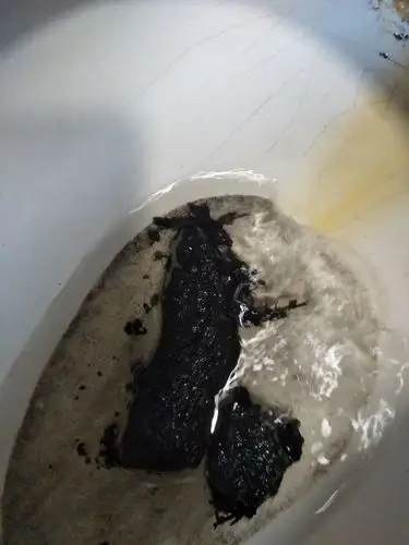 大便是黑色连续一个星期了