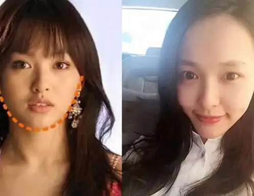 【图】唐嫣整容过吗? 整容传闻真相大揭秘