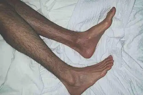 可能会有人认为,男孩子有腿毛男人味更足.