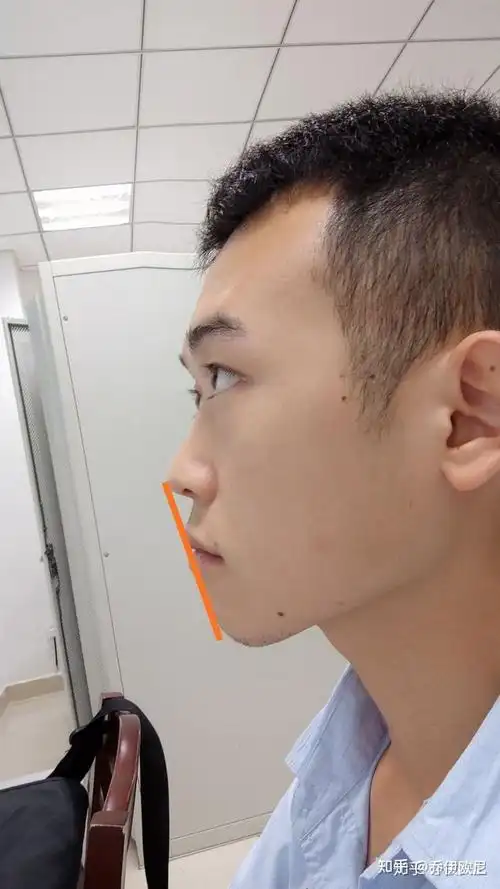 你见过塌鼻子的帅哥吗? - 知乎