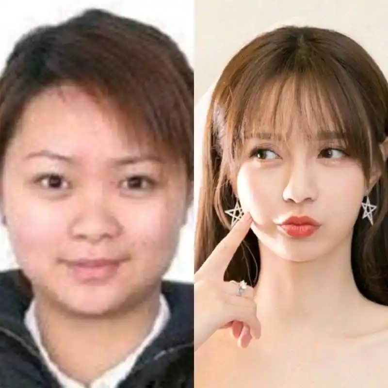 整容前沈梦辰整容对比沈梦辰整容对比 前后沈梦辰旧照