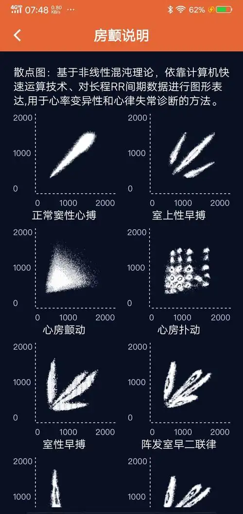 心房颤动散点图