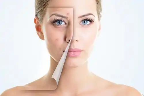 谨记这四点,肌肤就能摆脱敏感干燥!