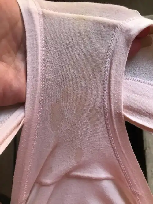 早上一会就觉得内裤湿了(是不是分泌物)