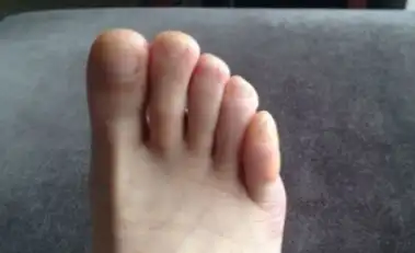 原创女生脚型分为3种第一种最美第3种最适合跳舞你是哪个