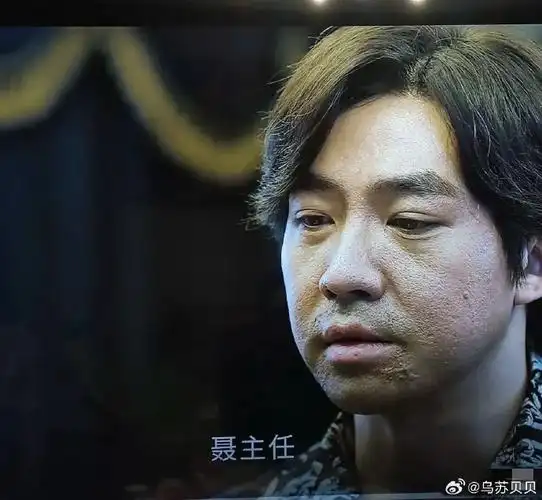 俞灏明脸上的烧伤好严重啊!