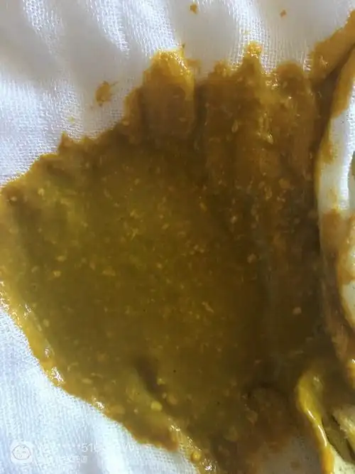 母乳喂养,宝宝粑粑有奶瓣是怎么回事?