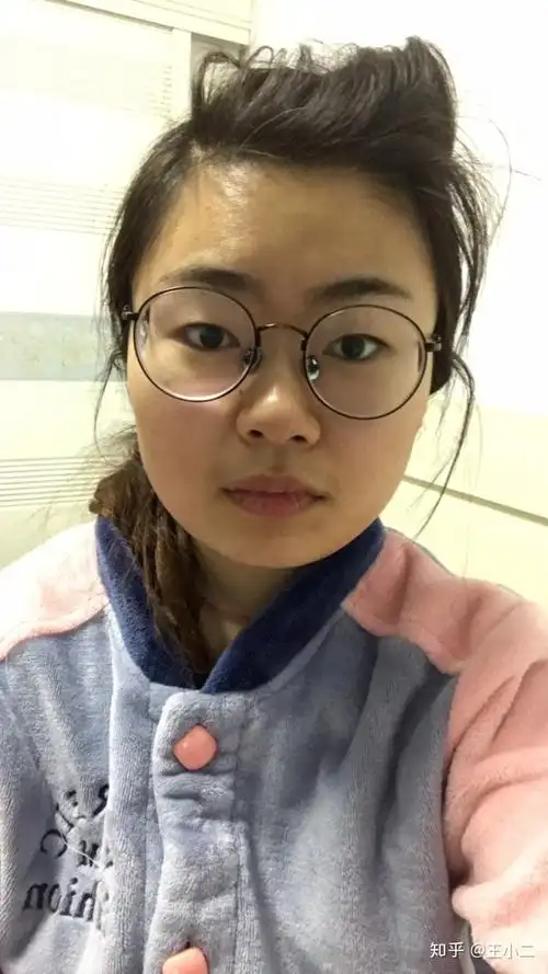 女生胖又难看是种怎样的体验