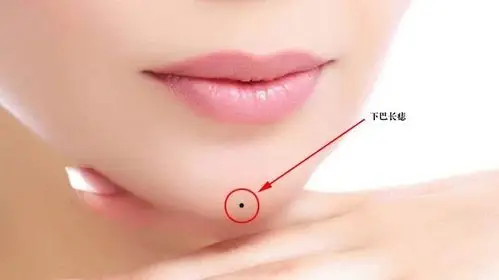 此处有招财痣 横财扎堆 财运不断 特别是第二个