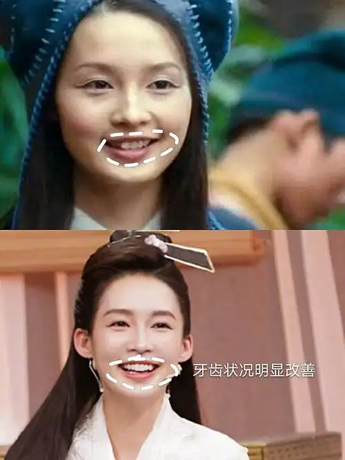 96去年大火的《庆余年》让鸡腿姑娘—李沁深入人心,她_圈子-新氧