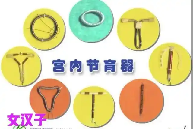 避孕环是什么,避孕环是什么样子图片(琳琅满目的节育环总有一款适合你