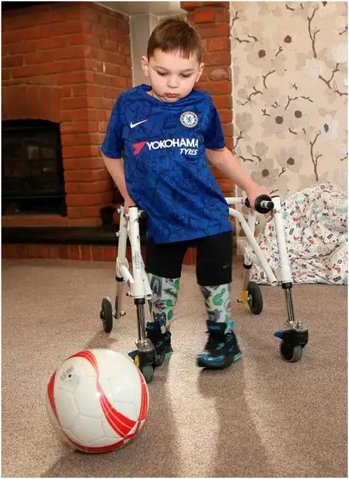 英国男童惨遭亲生父母残害如今换上假肢踢球笑对生活