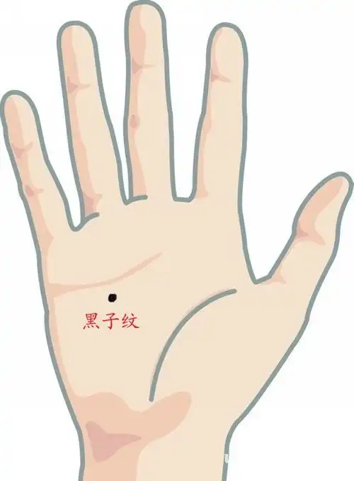 手相黑子纹图解