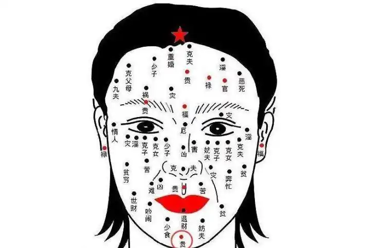 传说中的"发财痣",身上有一颗,注定财运大发,看看你有吗?