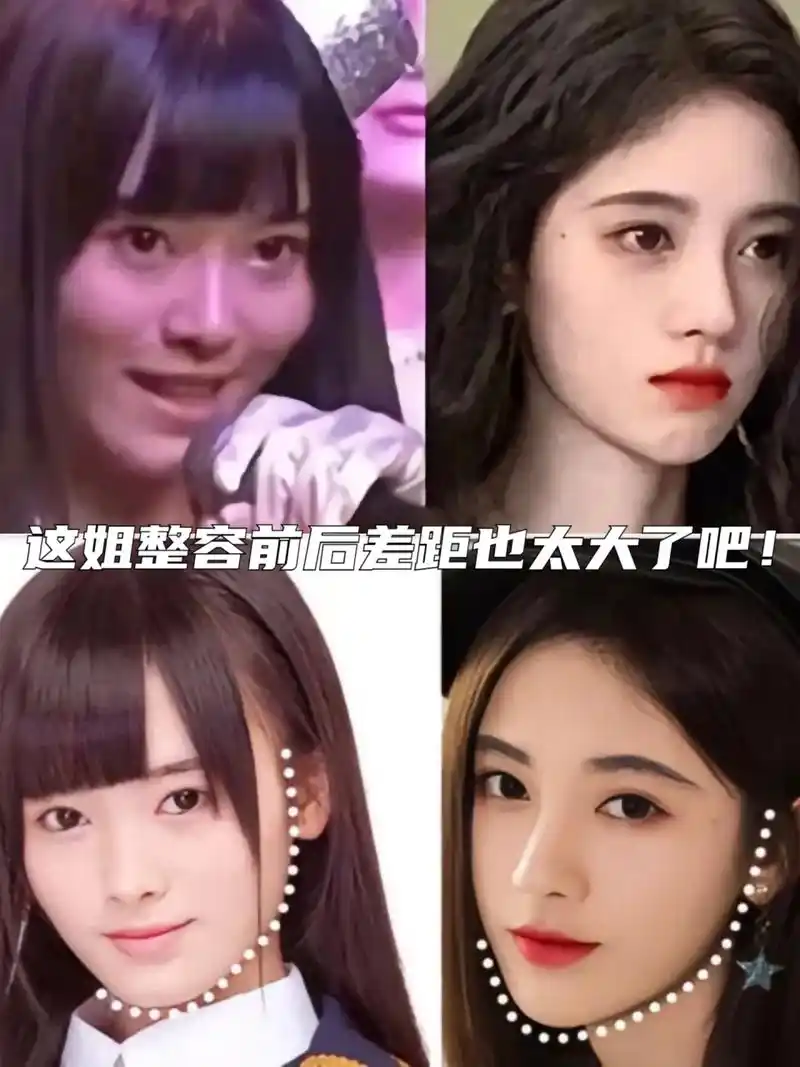 鞠婧祎整容前后对比!大变样! 整容后的鞠婧祎美得让人惊艳!