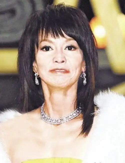 脸皮耸拉,额头痴肥,心情僵硬,"整容"后的中年演员,都翻车了