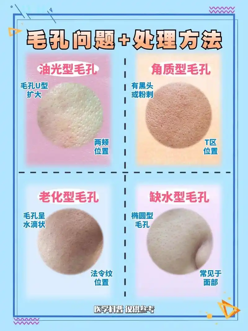 分清类型来解决#护肤 #毛孔粗大 #变美 # - 抖音