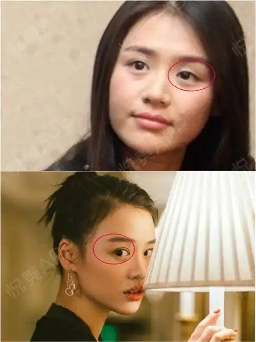 5马思纯马思纯曾经开玩笑称自己双眼皮比李荣浩的眼睛还宽但是这么宽