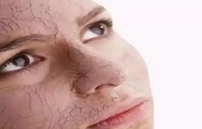 然而,人的皮肤随着气候环境温差较大,皮肤水分大量流失.