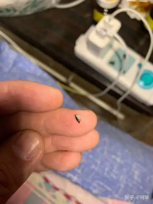 包皮环切术,钛钉脱落期间更新