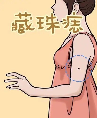 今天说说手臂上的痣,有这几种说明你艳福不浅,财运滚滚哦