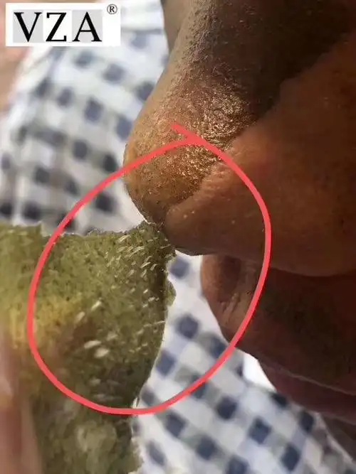 vza绿茶去黑头粉刺面膜