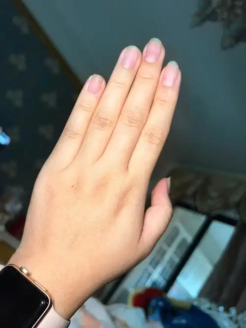 听说左手有痣的人会有一个很爱很爱她的人,近两年左手长出来一颗痣