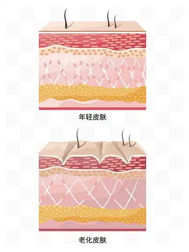 1329皮肤年轻化年老化对比示意图133740流程图.