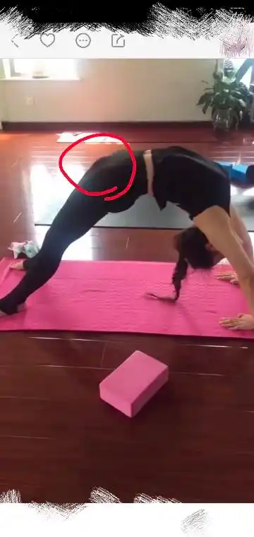 女生下腰时那是什么部位为什么会凸起来,不疼吗