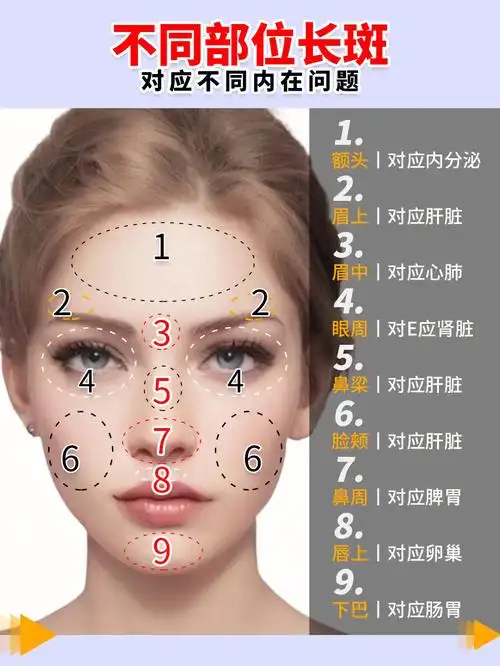不同部位长斑对应不同内在