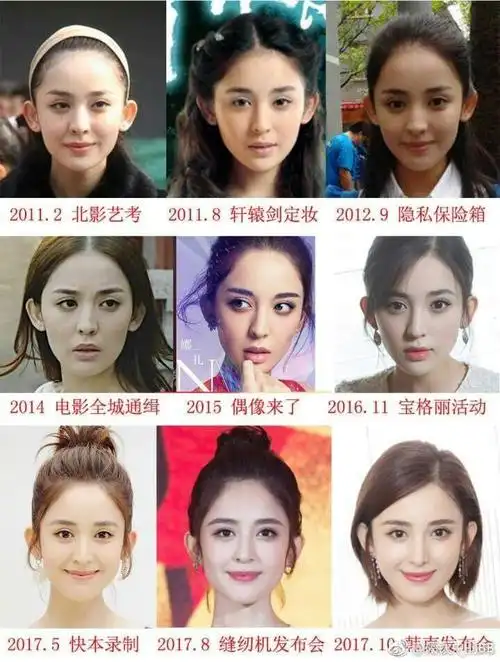 为什么古力娜扎要整容?