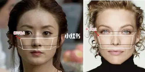 94简单易懂的判断颧骨高还是颧弓宽的方法?