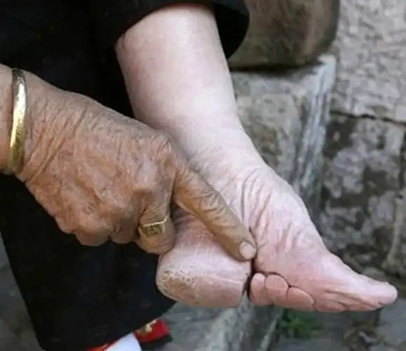 让人无法理解的小脚审美,在我国流传近千年,当时的人们咋想的