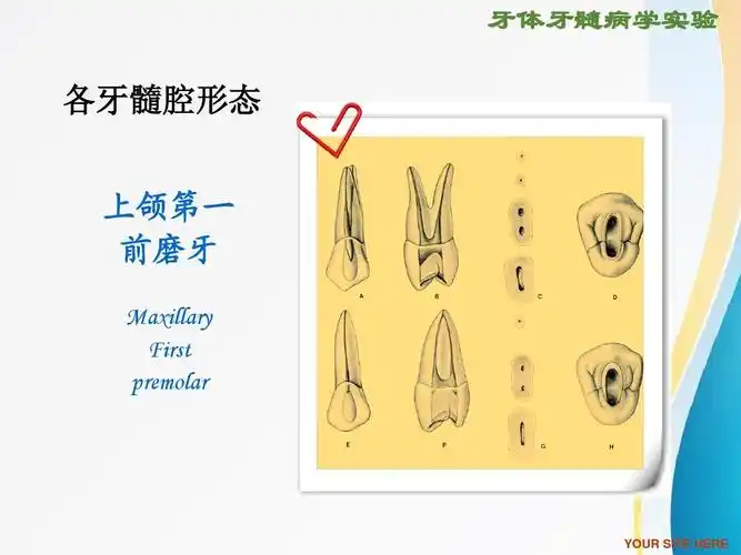 rct根管治疗ppt 牙体牙髓病学实验 各牙髓腔形态 上颌第一 前磨牙