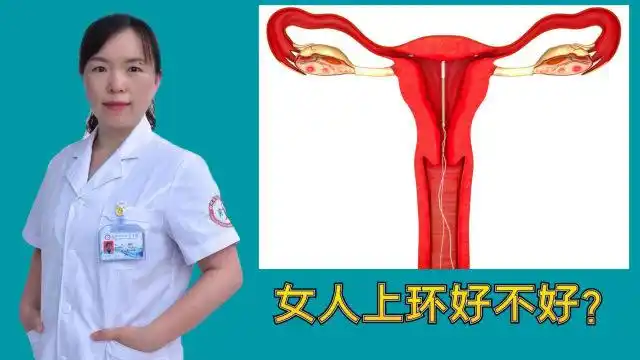 女人上环好不好?医生提醒:这些不良反应,女性朋友应了解