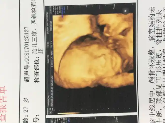 好孕帮!六个月四维彩超男孩图"兢兢业业"-第1张图片-吉泽网