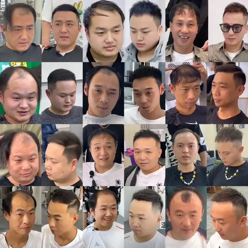 男生高发际线男生改变今天给大家推荐一款高.