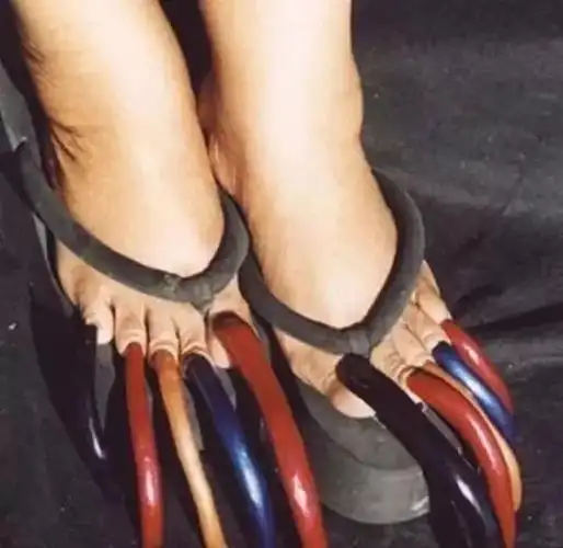 世界上最瘦的男人,真正的皮包骨!