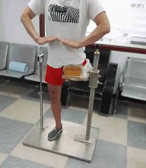 髋离断假肢的装配工艺比较复杂,较早以前为单侧髋离断和半骨盆切除