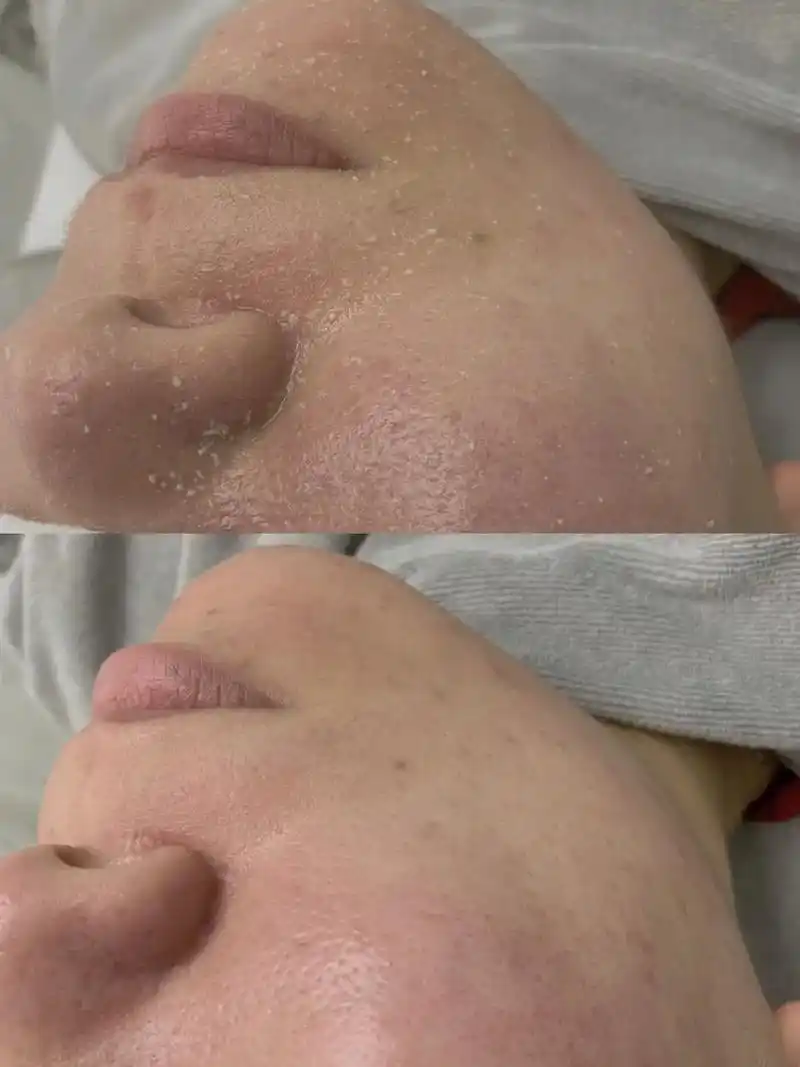 深层清洁一定要做 不然你不知道自己的皮肤有多脏 深层清洁 - 抖音