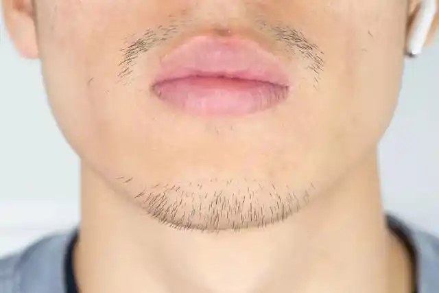 [原创] 胡须长得快,是什么原因?刚刮了胡子,隔天就长出来了