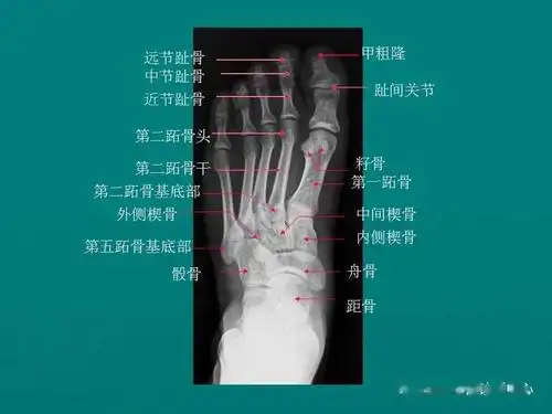 四肢骨骼正常影像解剖
