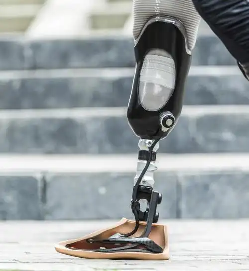 截肢后多久可以安装假肢