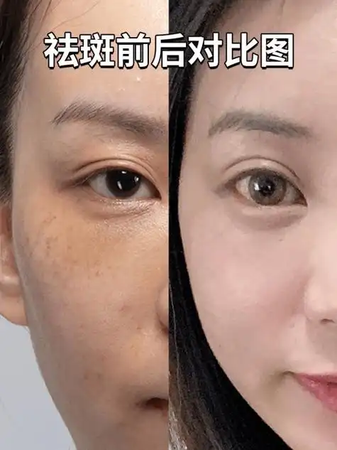 国家认证的祛斑产品都有哪个?选这几款,性价比好