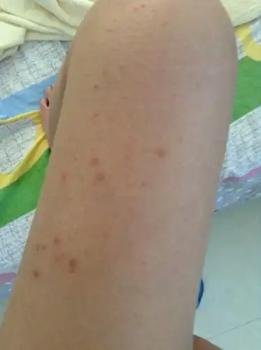 问:请问这个腿的皮肤是怎么了 需要看医生吗