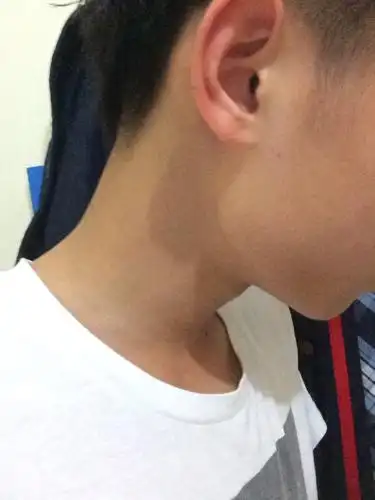 问:我的耳朵好像没耳垂,细细的 能打耳洞吗