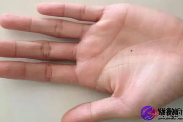 左手心有痣的女人代表着什么呢